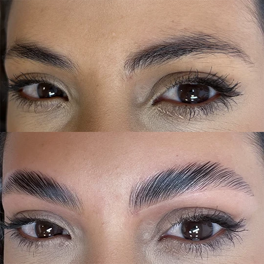 Antes e Depois
